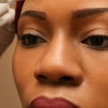 What is the best non surgical treatment for aging skin?
